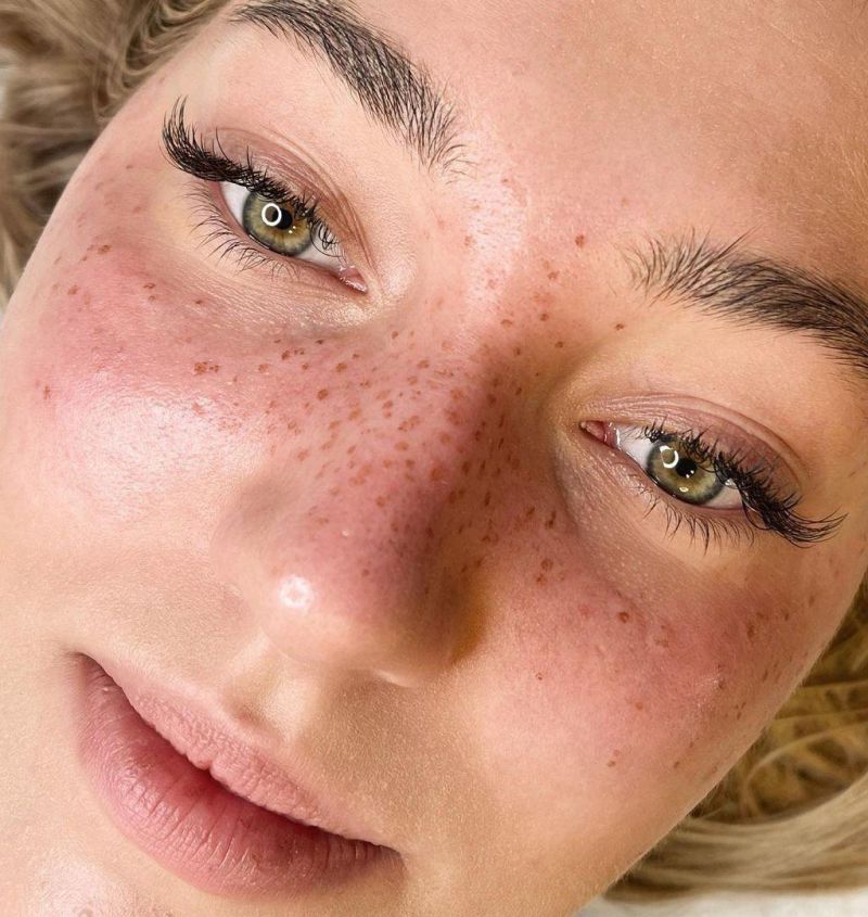 30 Unique Freckle Tattoos to Inspire You