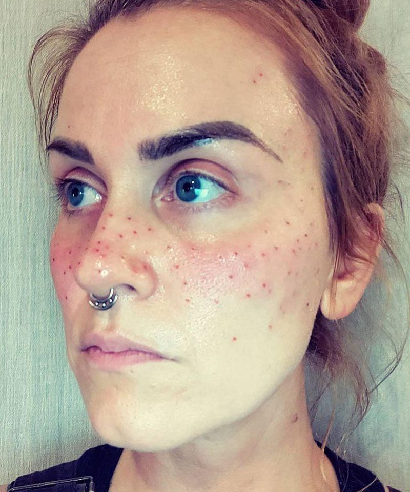 30 Unique Freckle Tattoos to Inspire You