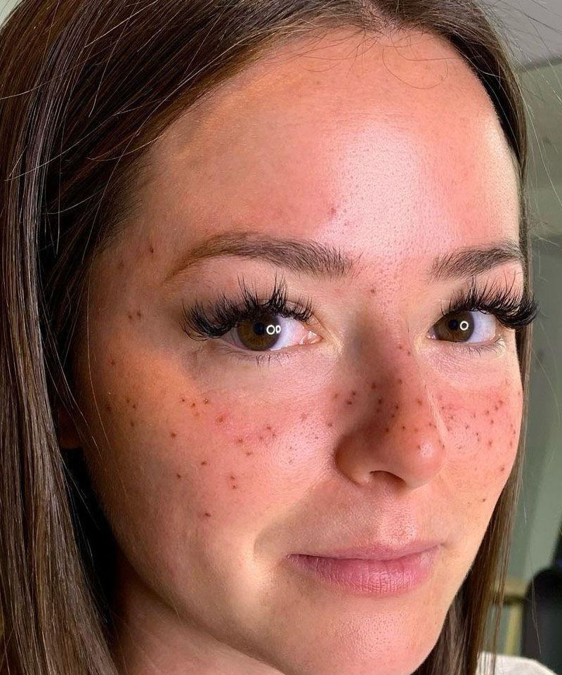 30 Unique Freckle Tattoos to Inspire You